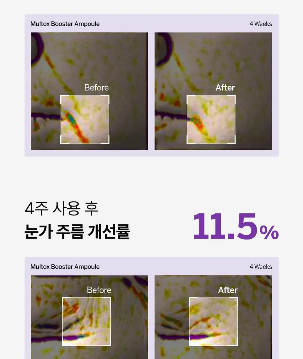 [올리브영단독] 비노트 물톡스 부스터 앰플 30ml 기획 (+데일리샷 1.5ml*5ea) 상세페이지 30